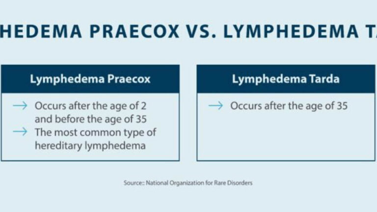lymphedema precox vs tarda