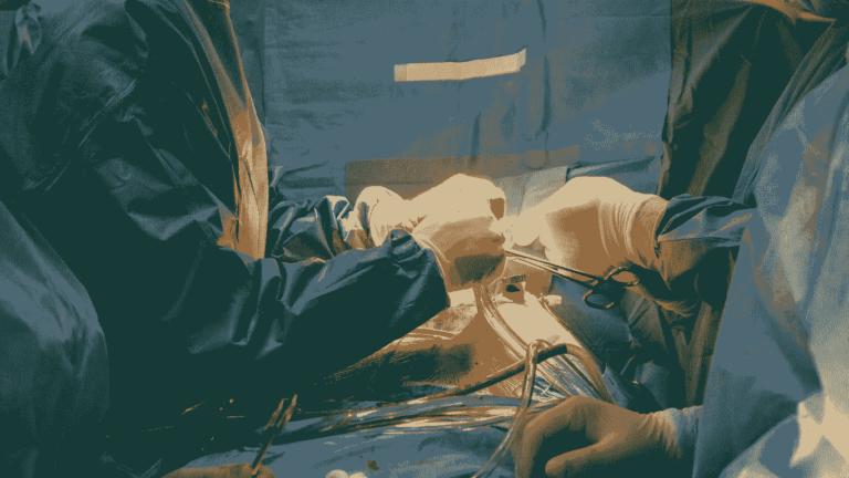 lymphovenous bypass surgery