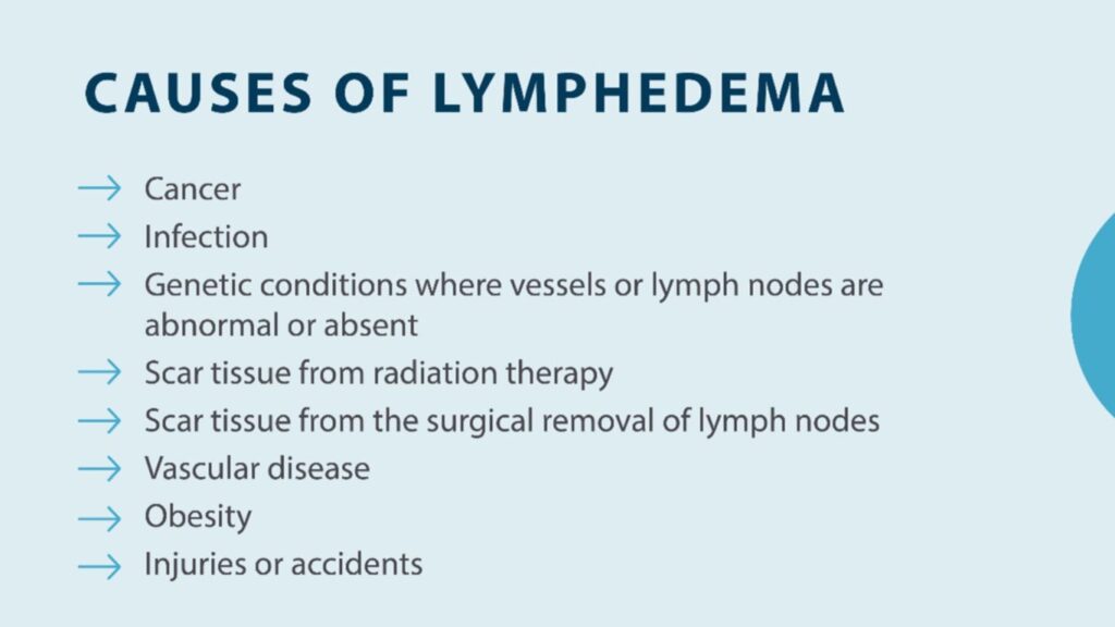 Causes Lymphedema to Worsen