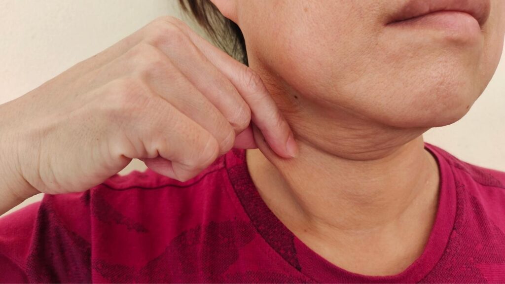 Lymphedema-in-the-Face-and-Neck-Diagnosis-and-Treatment