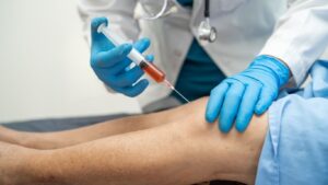 PRP therapy enhances lymphatic repair & tissue regeneration.
