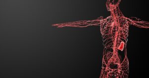Understanding Lymphatic Dysfunction and Its Impact on the Immune System in Lymphedema