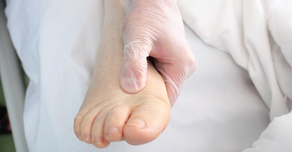 Understanding Primary Lymphedema and the Role of Genetics in Disease Progression