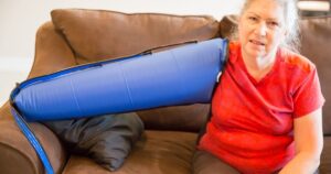 Lymphedema and Posture Causes, Effects, and Care Tips