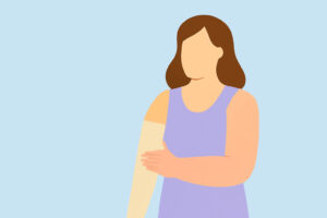 Lymphedema Compression Garments for Swelling