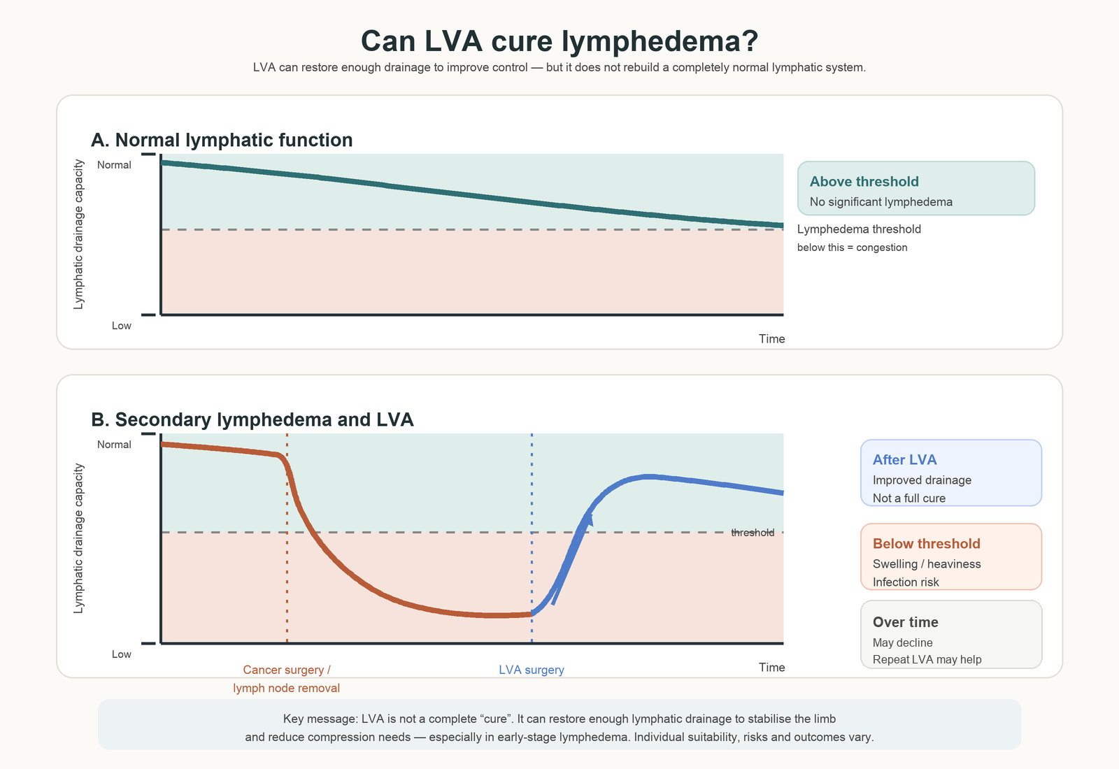 Lymphedema Education and LVA Surgery Resources in Singapore 5 Diagram explaining how LVA can improve lymphatic drainage without fully curing lymphedema