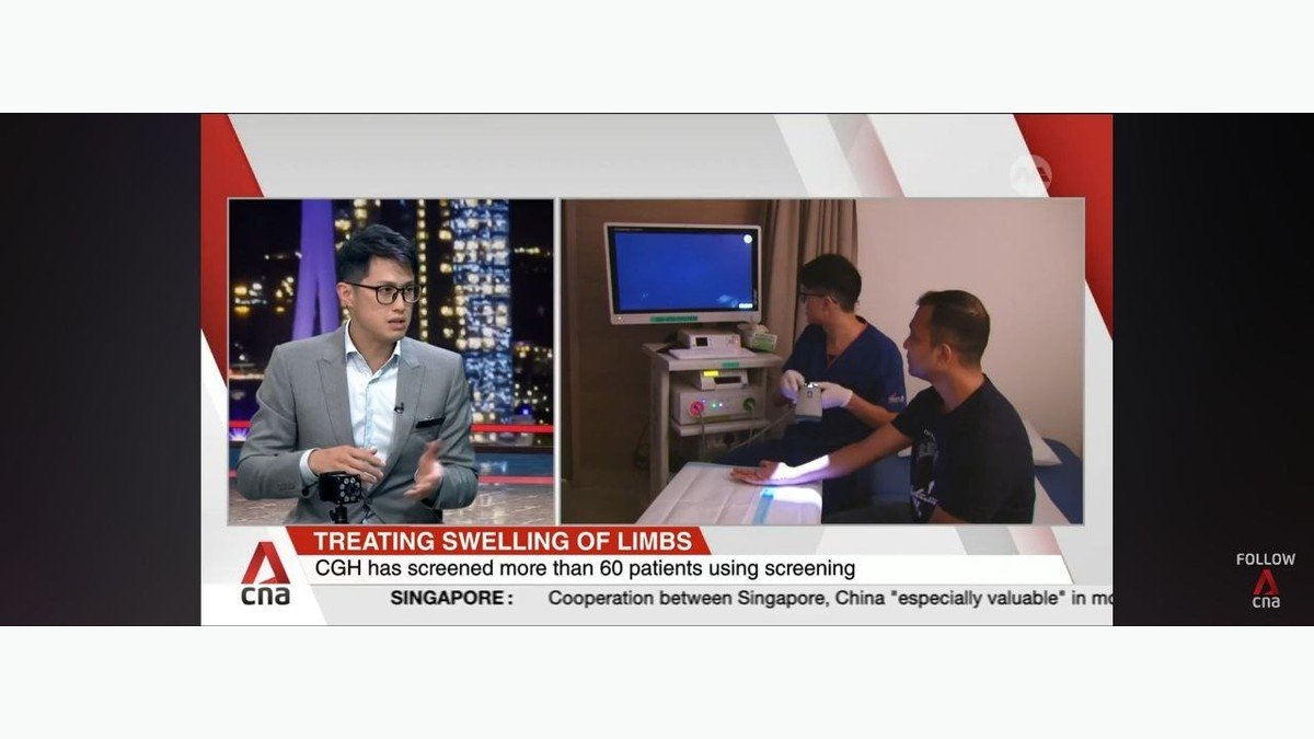 Channel NewsAsia media feature thumbnail about early screening and relief for lymphoedema patients