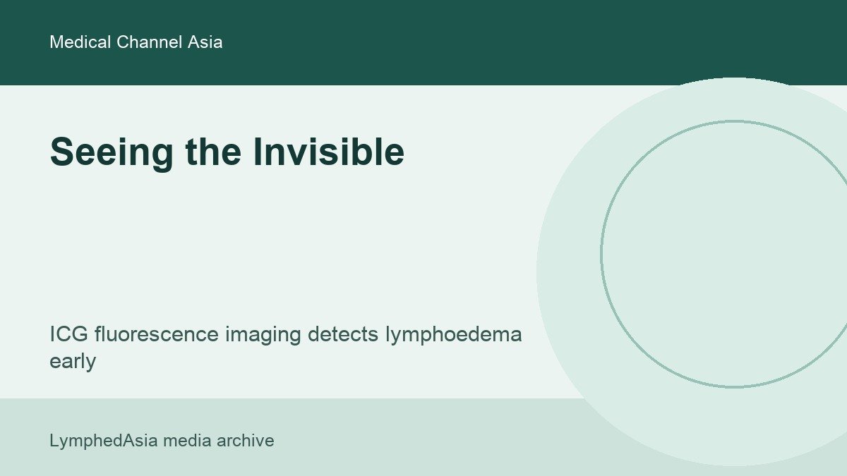 Medical Channel Asia feature thumbnail about ICG fluorescence imaging for lymphoedema